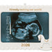 Decorative ornament with ultrasound image and 'Already rocking our world.' text, featuring a rocking horse design.